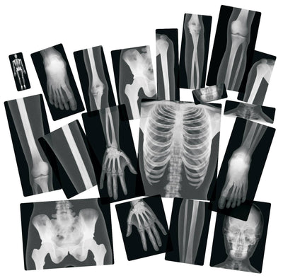 True To Life Human X-Rays